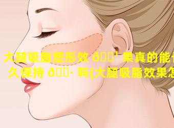 大腿吸脂塑形效 🌹 果真的能长久保持 🕷 吗(大腿吸脂效果怎么样会不会反弹)